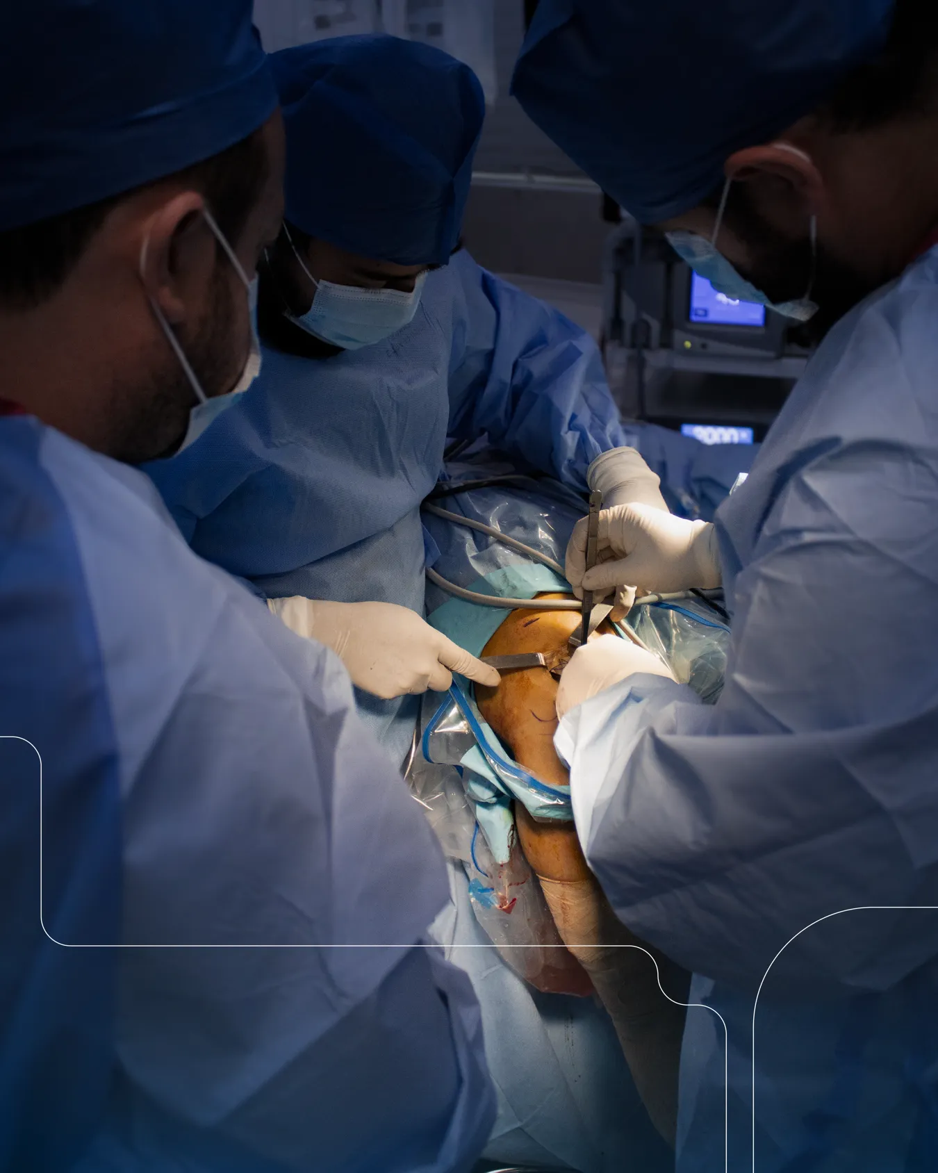 El Dr. Lizandro Lizama y su equipo durante una cirugía de rodilla